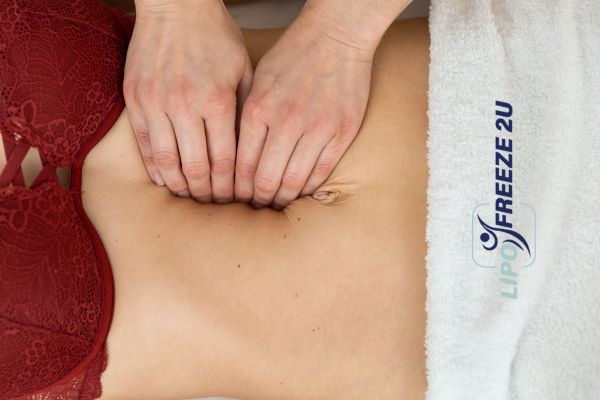 diastasis recti treatment Chorleywood