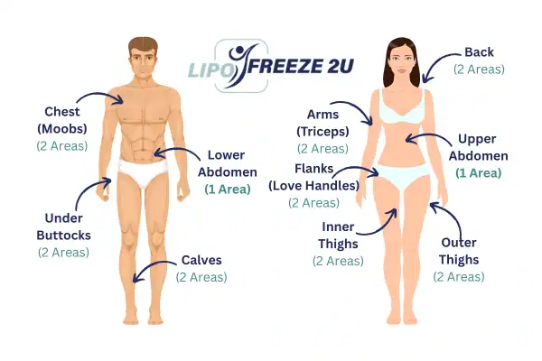 Areas you can have fat freezing treatment Chorleywood