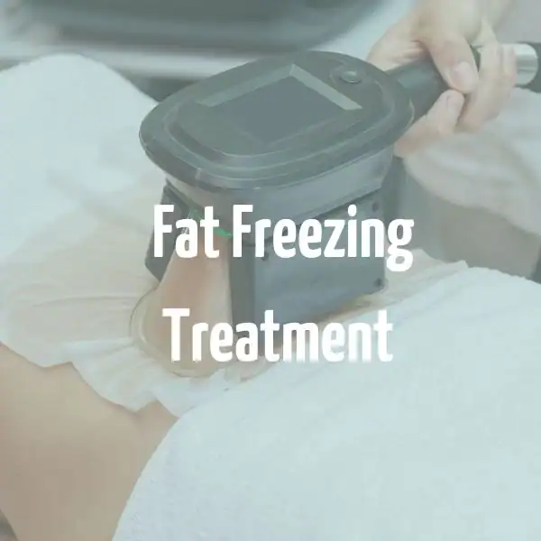 fat freezing treatment Chorleywood