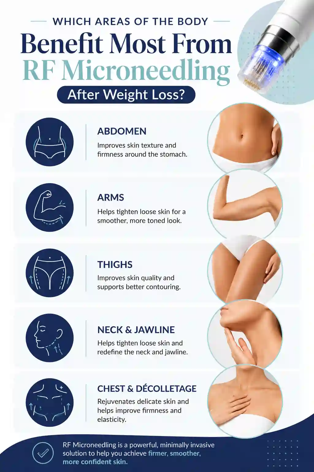 Which Areas of the Body Benefit Most From RF Microneedling After Weight Loss Chorleywood